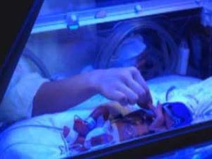 İkizler 8 gün arayla doğdu