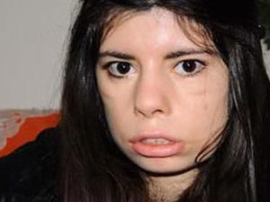 Tek dileği kızının güldüğünü görmek