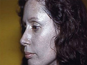 Burun damlası kullandı, rengi gri oldu