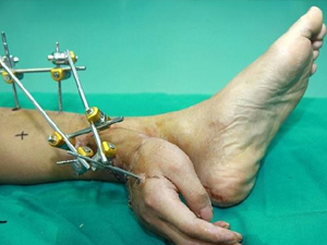 Böylesini görmediniz! Kopan elini, ayağına...