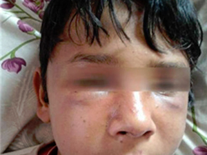 Bu nasıl insanlık! Çocuğu önce dövdüler sonra...