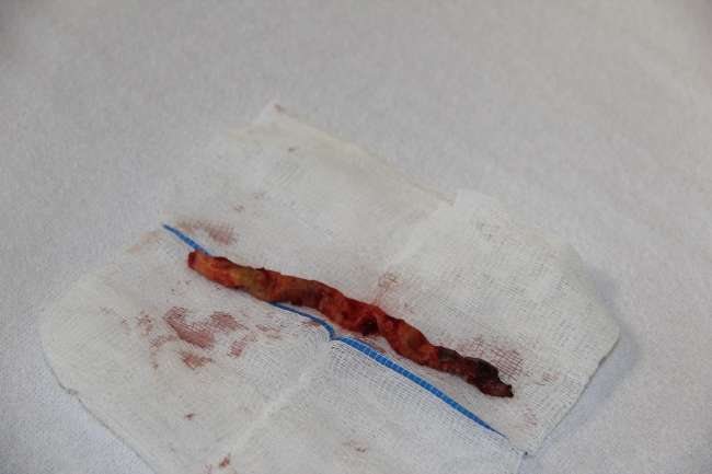 Bunu gören doktorlar bile hayrete düştü!