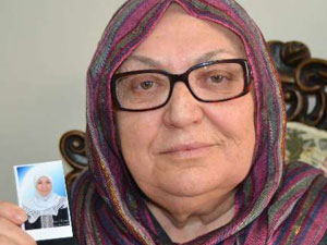 63 yaşında botoksa kalkıştı hayatı mahvoldu!