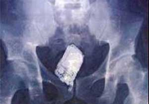 Telefon makatlarına gizlenmiş