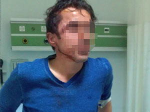 Sopalı saldırıda hastanelik oldu