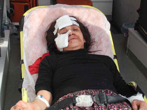 İşte kıskanç kocanın eseri