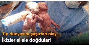 İkizler el ele doğdular