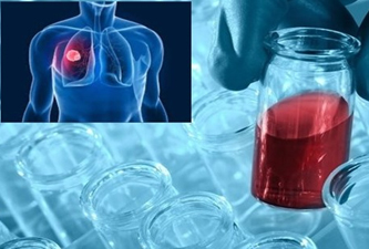 Akciğer kanserinde umutlar yeşerdi!