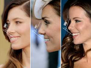 İdeal burun açısı 106 derece