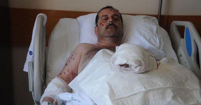 İftar topu patlatırken eli koptu