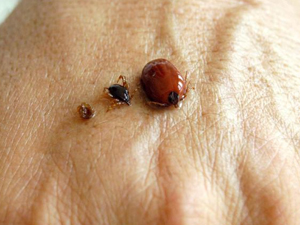 Dikkat! En çok bu dönemde görülüyor!