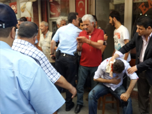 MHP’li başkanın eşi darp edildi