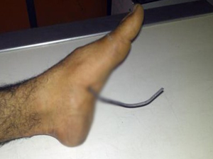 Yolda yürürken ayağına...