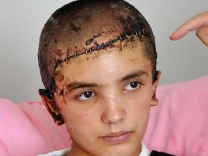 Kafa derisi koptu! Trabzon'da...