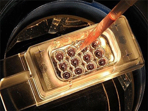 Ebola can almaya devam ediyor