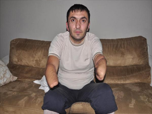 Yüksek gerilime kapıldı, el ve ayakları kesildi