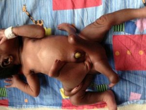 Ahtapot bebek görenleri şaşırtıyor