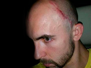 Adrian ölümden döndü!