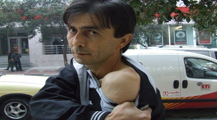 Başına cam düştü