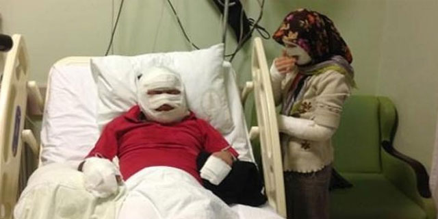 Karı-kocayı oda spreyi bu hale getirdi!