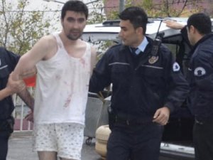 Annesinin yüzünü parçaladı!