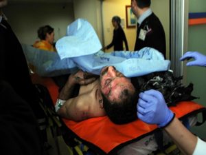 Barışmak isteyen eşini yaktı!