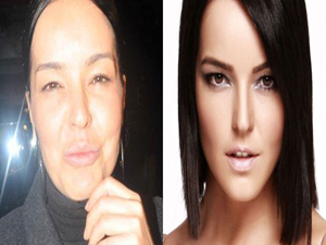 'Ne botoksu arkadaşlar' dedi ama...