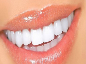 Diş eti hastalığı dişleri döküyor