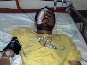 Ordu'da domuz saldırısı!