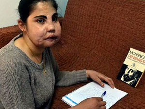 Yüz nakli kitap oluyor