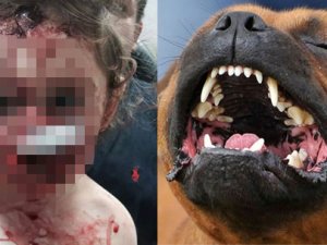 18 aylık bebeği bu hale getirdi