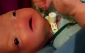 Dünya bu bebeği konuşuyor! Çünkü...