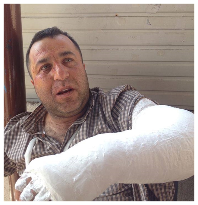 Dernekpazarı'n da kaza 1 yaralı