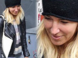 Burcu Esmersoy'un yüzüne ne oldu?