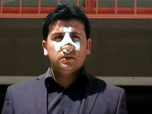 Öğretmeni hastanelik ettiler