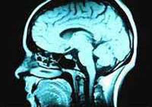 Beyin taramasıyla zanlı bulundu