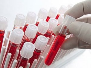 Hangi kan grubu daha şanslı?