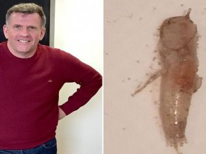 Öksürüğüyle ağzından çıkardı şok oldu!