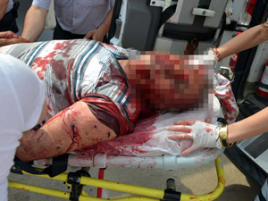 Kavgayı ayırmak isterken canından oldu