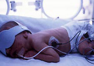 Bebek ölümlerinin nedeni belli