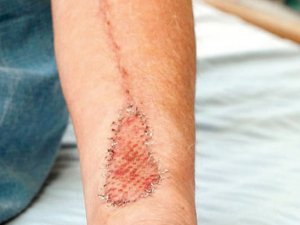 Kolundan ‘dil’ yaptılar!