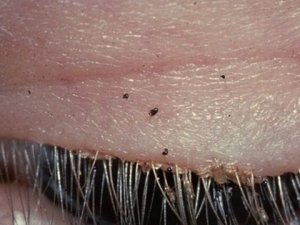 Doktorları dehşete düşüren görüntü