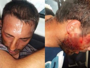 Dolmabahçe Saldırısının Ayrıntıları Ortaya Çıkmaya Başladı