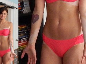 Sorulardan sıkılınca hastalığını dövme yaptırdı