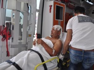 İşçinin üzerine sıcak zift döküldü