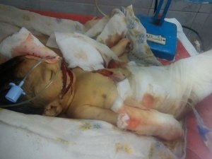 Fareler 10 günlük bebeği öldürdü