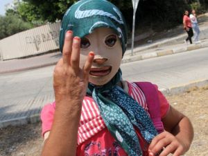 Savaşın acı yüzü