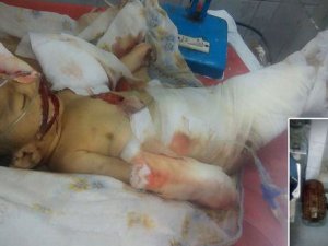 10 günlük bebeği fare yedi!