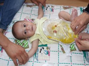 Bağırsakları dışarıda yaşayan Velid yardım bekliyor