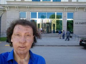 Yüz nakli yapılan kişi aday adayı oldu